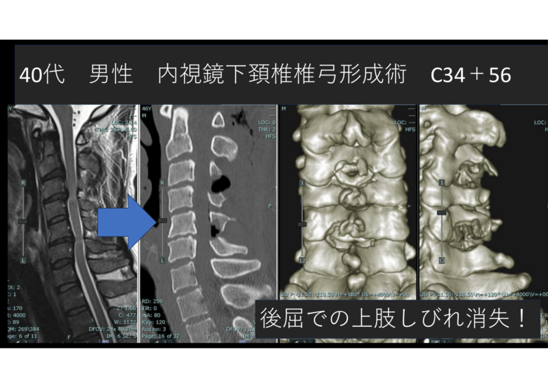 医者が選ぶ日帰り内視鏡脊椎手術 2025年前半編のアイキャッチ画像