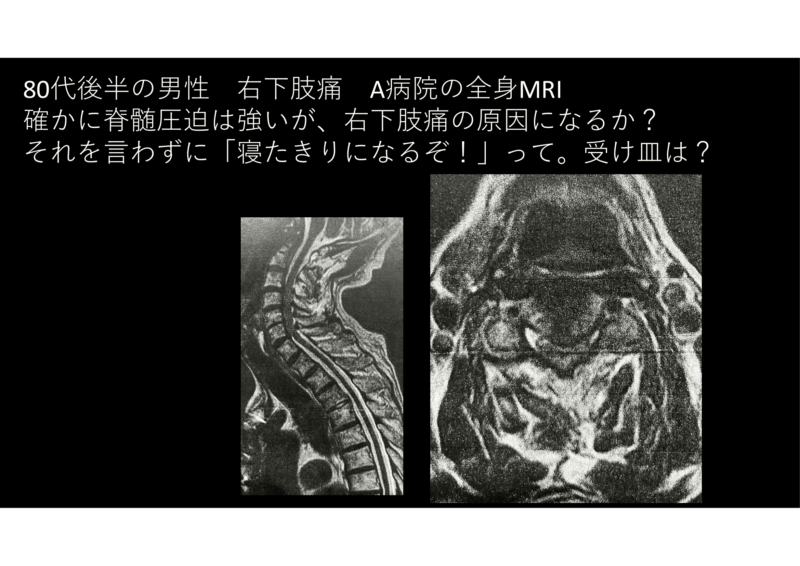 「寝たきりになるぞ」に要注意！　のアイキャッチ画像