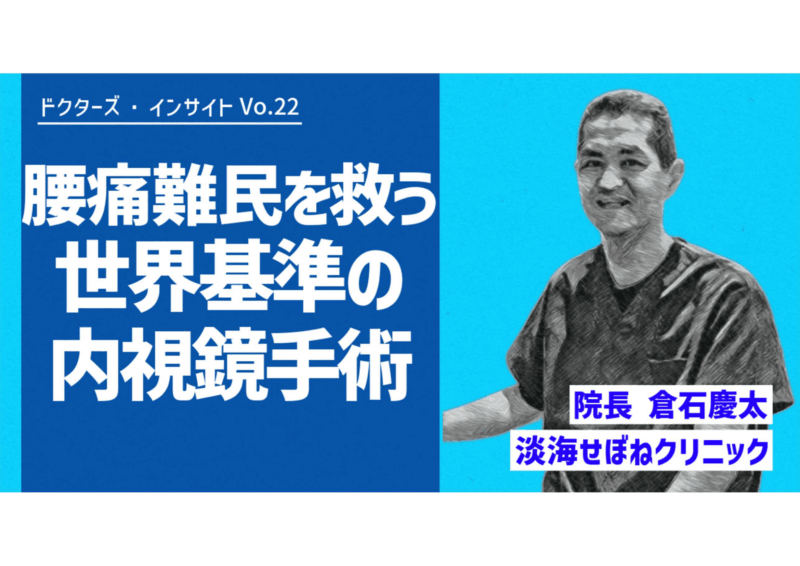 「腰痛難民を救う、世界基準の内視鏡手術」のアイキャッチ画像