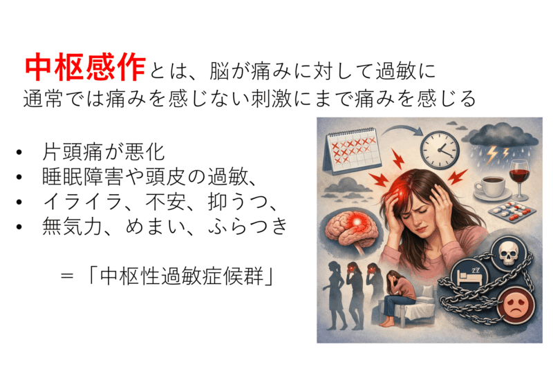 エムガルディを忘れた=中枢性感作の改善!のアイキャッチ画像