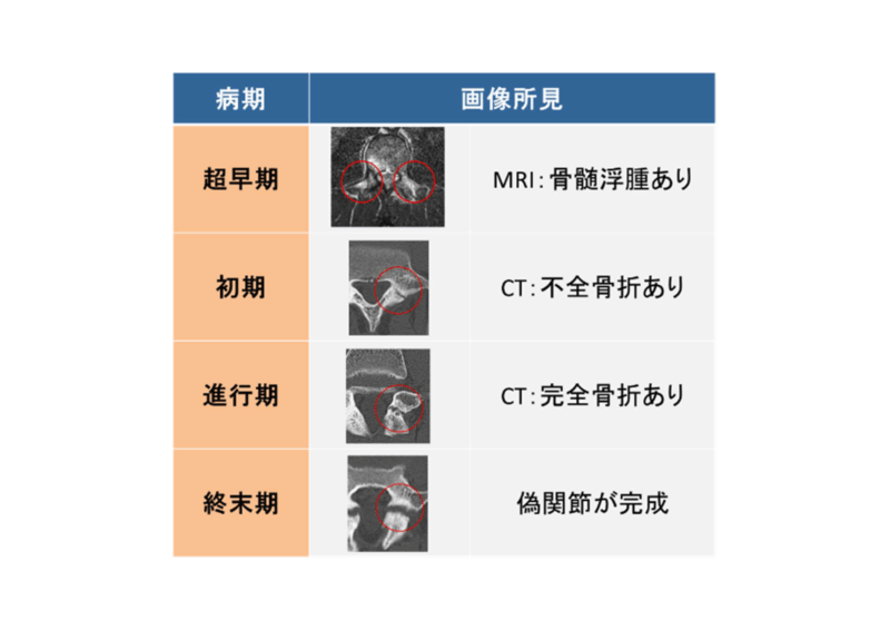 今、腰が痛いままだらだらとクラブをしたいですか？それとも一生スポーツを思いっきり楽しみたいですか？のアイキャッチ画像