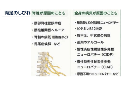 両足のしびれは、手術で治るのでしょうか? ―脊椎外科医が最も慎重になる症状―のアイキャッチ画像