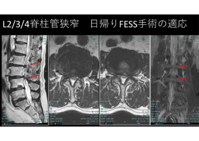 ある紳士の術後　八幡堀、比叡山観光のアイキャッチ画像