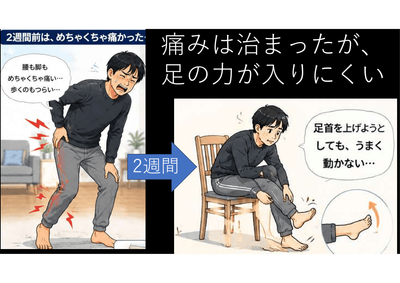 痛みないが、足の力が入らない小さなヘルニア→勇気をもって手術のアイキャッチ画像