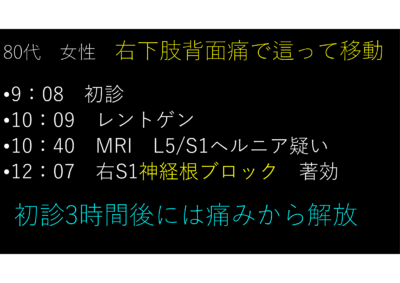 神経根ブロックについて②のアイキャッチ画像