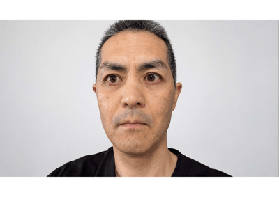 目が痛いコラムのアイキャッチ画像